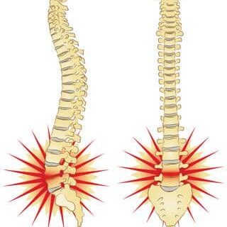 dyskopatia